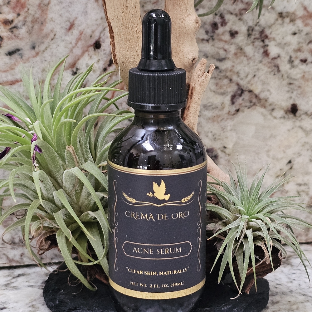 Acne Serum - Clear Skin Naturally